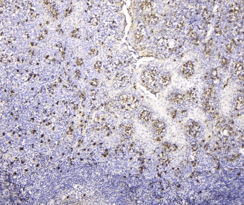 Polyclonal Rabbit anti-Human IGLL1 / CD179b Antibody (IHC, WB)