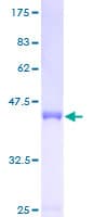 Human ASF1B Protein (Recombinant GST)
