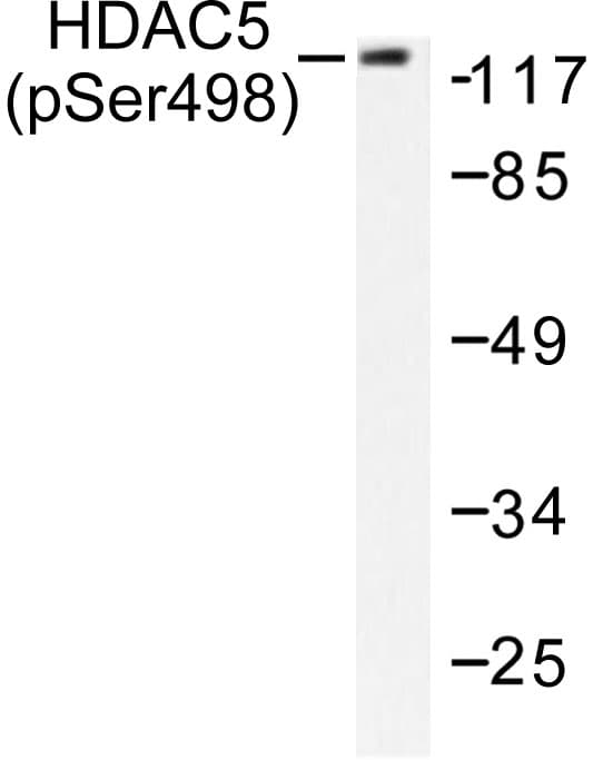 HDAC5 Antibody (phospho-Ser498)