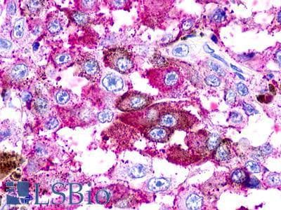IHC-plus™ UTS2R / GPR14 Antibody (Cytoplasmic Domain)