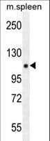 Polyclonal Rabbit anti-Human PELP1 Antibody (aa744-771, IHC, WB)