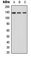 INPPL1 / SHIP2 Antibody (Internal)
