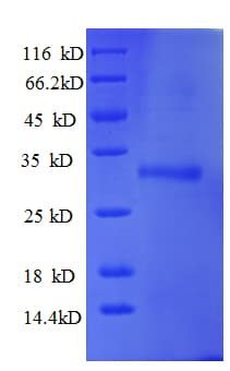 Human UBE2W Protein (Recombinant His-SUMO)