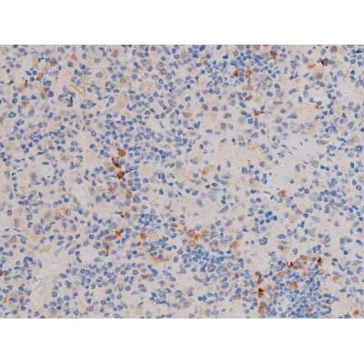 CDC25A Antibody (phospho-Ser75)