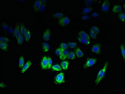 TM4SF6 / TSPAN6 Antibody