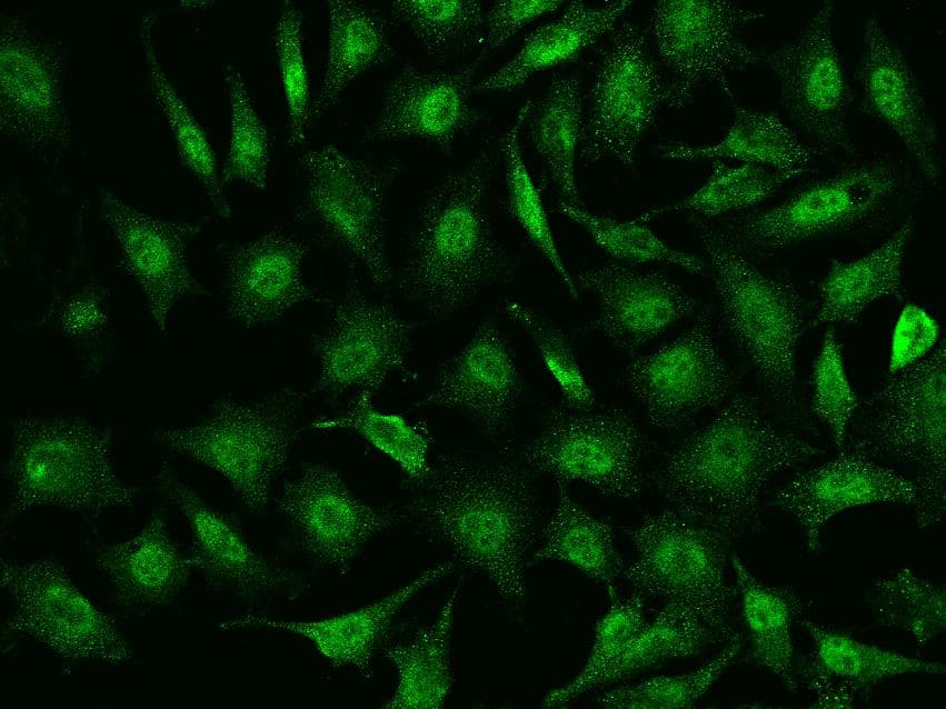 TIPIN Antibody