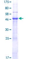 Human PTOV1 Protein (Recombinant GST)