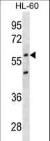 CDKN1C / p57 Kip2 Antibody (aa34-64)