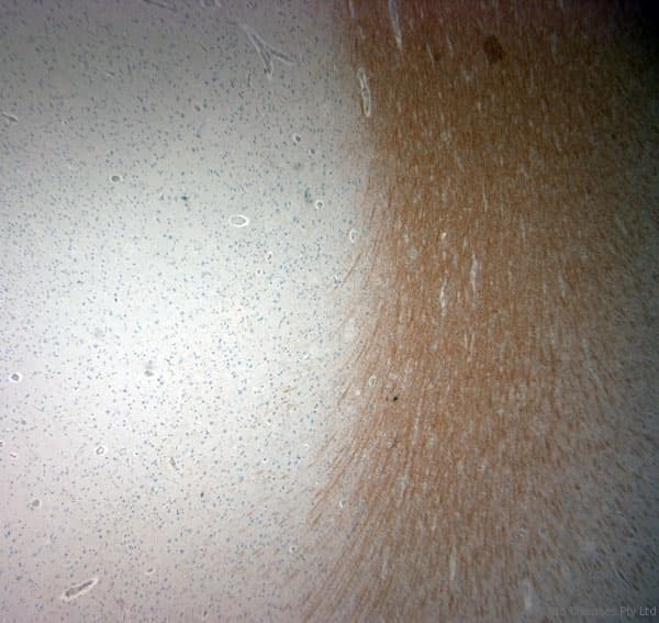 Polyclonal Rabbit anti-Human MBP / Maltose Binding Protein Antibody (aa180-220, IHC)