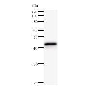 Monoclonal Mouse anti-Human PRKAR1A Antibody (clone 3546C2a, WB)