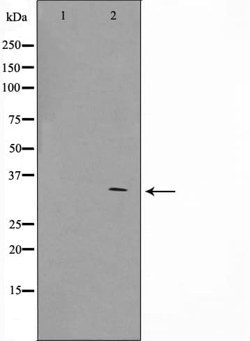 ZNF498 Antibody