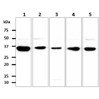 GPD1L Antibody (clone AT14E2)