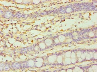 CYP3A5 Antibody (aa233-502)