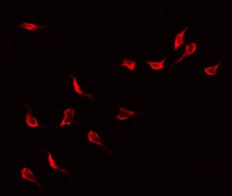 Polyclonal Rabbit anti-Human p56lck / LCK Antibody (IF, WB)