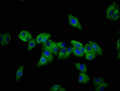 DSC3 / Desmocollin 3 Antibody