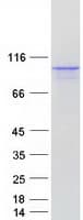 Human USHBP1 Protein (Recombinant Myc-DDK (Flag))