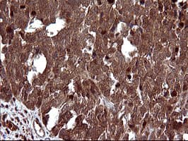 UPRT Antibody (clone OTI2D1)