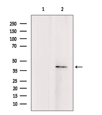TMOD4 Antibody