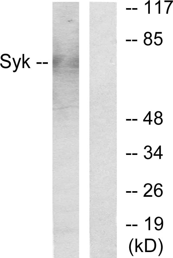 SYK Antibody (aa141-190)