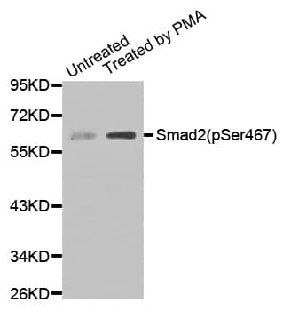 Polyclonal Rabbit anti-Human SMAD2 Antibody (phospho-Ser467, WB)