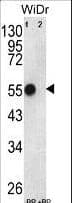 IHC-plus™ Polyclonal Rabbit anti-Human ATP5B / ATP Synthase Beta Antibody (aa135-163, IHC, WB)
