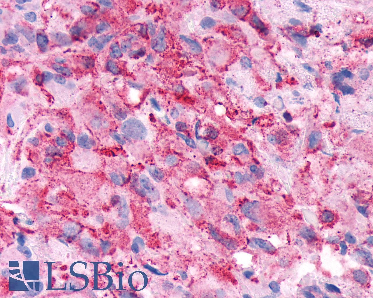 PathPlus™ FZD5 / Frizzled 5 Antibody (Cytoplasmic Domain)