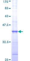 Human ATM Protein (Recombinant GST, N-terminus)