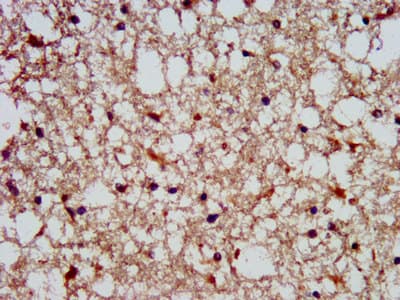 Polyclonal Rabbit anti-Human SLAIN1 Antibody (IHC, WB)