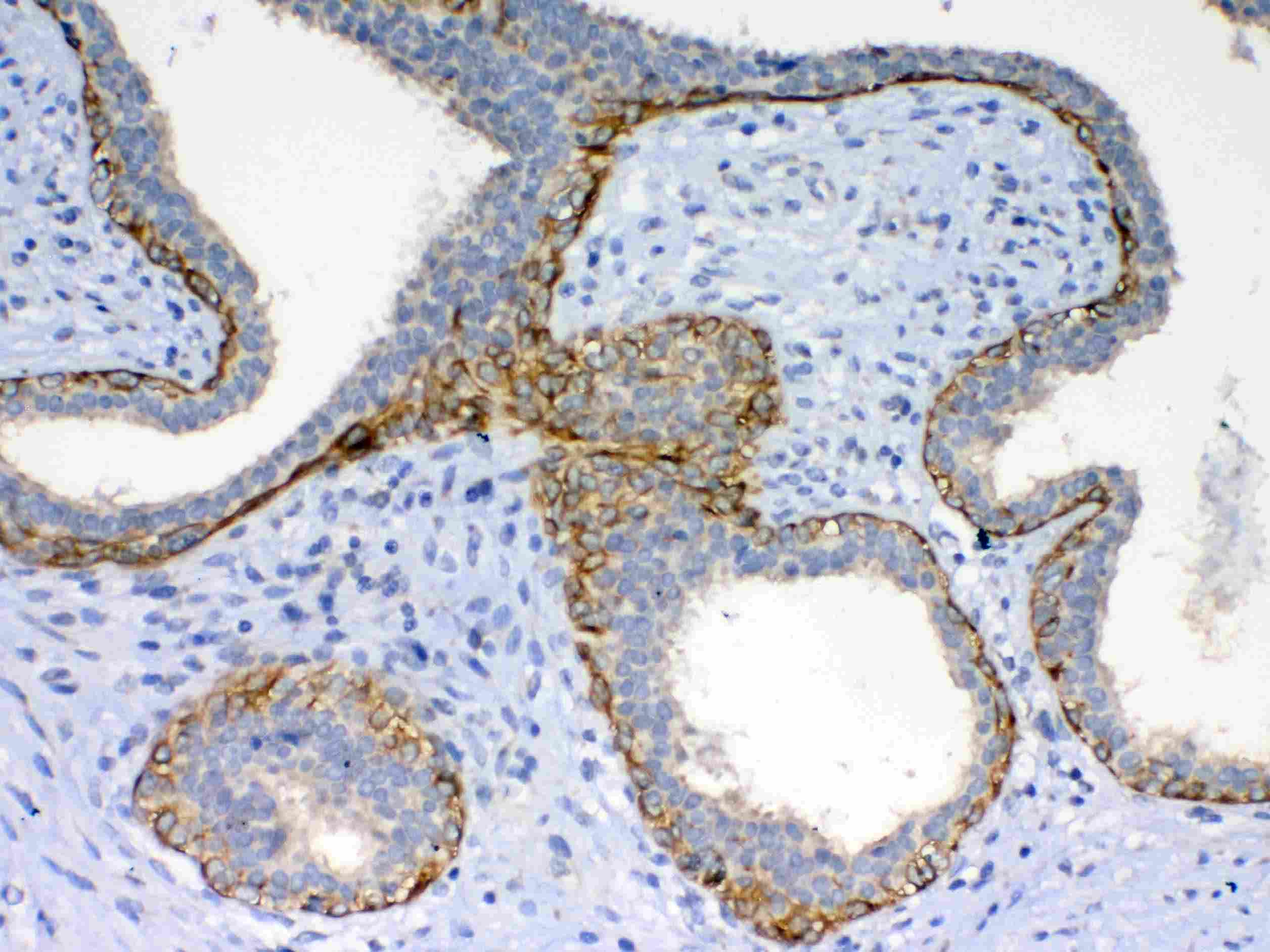 FZD4 / Frizzled 4 Antibody