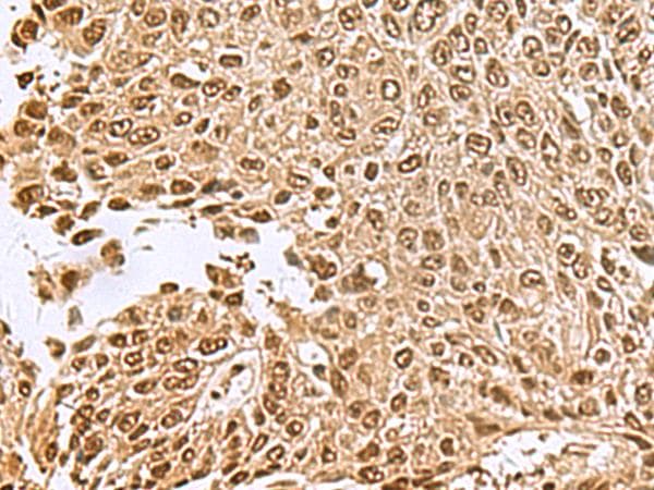 NVL Antibody