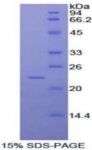 Human RAD54L2 Protein (Recombinant His)