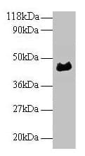 ORM1 / Orosomucoid Antibody