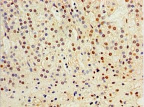 CST6 / Cystatin E/M Antibody (aa29-149)