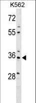 PDLIM4 / RIL Antibody (aa74-103)