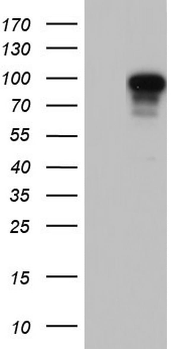 BFSP1 / Filensin Antibody (aa405-665, clone OTI3H6)