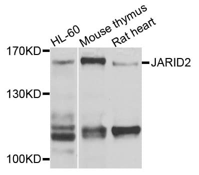 Polyclonal Rabbit anti-Human JARID2 / JMJ Antibody (WB)