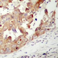 PAK1 Antibody (Internal)