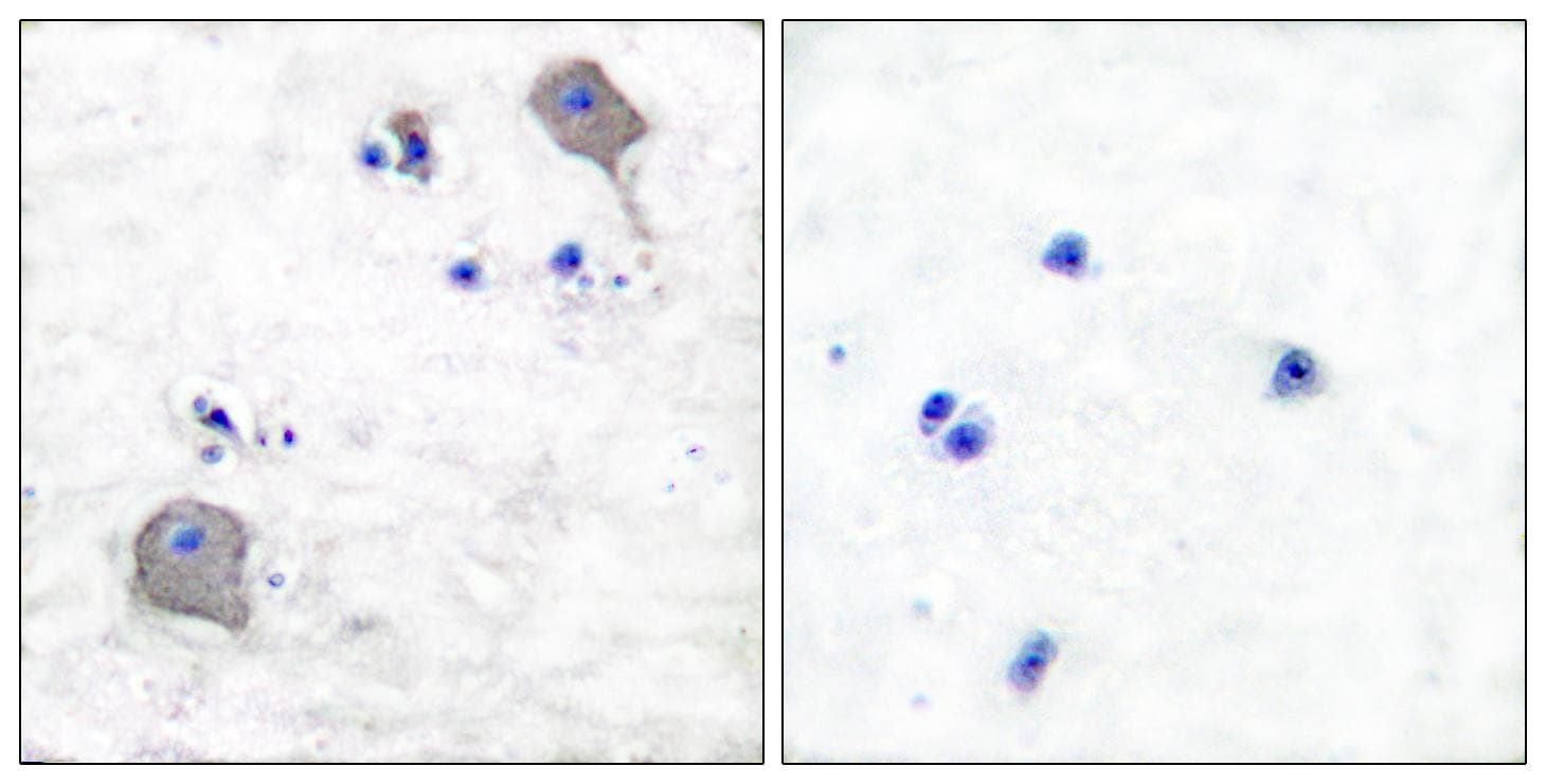 Polyclonal Rabbit anti-Human CLDN5 / Claudin 5 Antibody (IHC, WB)
