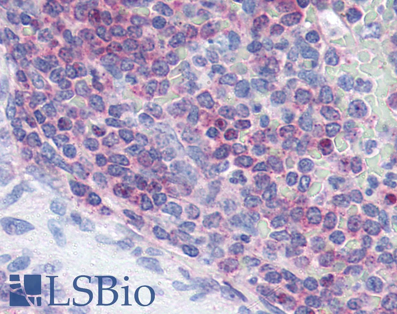 IHC-plus™ XCR1 Antibody (Extracellular Domain)