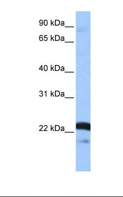 Polyclonal Rabbit anti-Human SRSF9 / SFRS9 Antibody (aa137-186, IHC, WB)