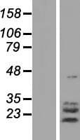 TPPP3 Protein (Over-Expression Lysate Myc-DDK (Flag))