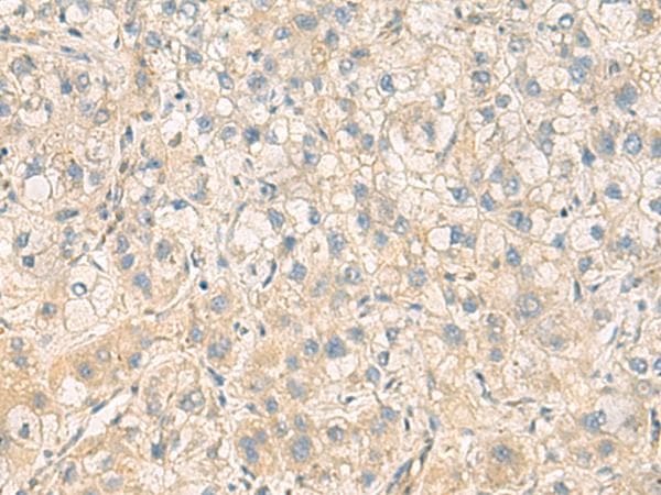 Polyclonal Rabbit anti-Human PPM1M Antibody (IHC)