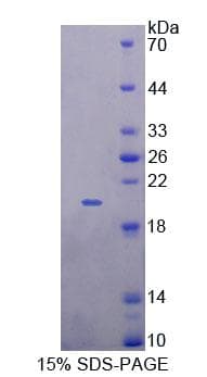Human GPR151 Protein (Recombinant His-T7, N-terminus)