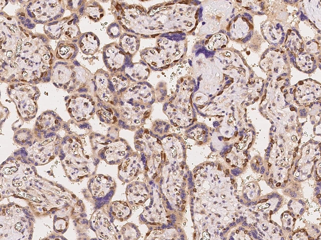 KIAA1462 Antibody