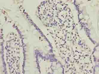 OOSP2 / PLAC1L Antibody
