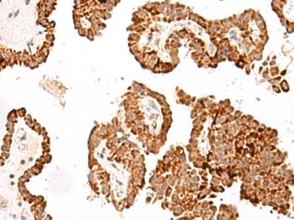 Polyclonal Rabbit anti-Human GFI1B Antibody (IHC)