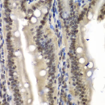 NELFE / RD / RDBP Antibody
