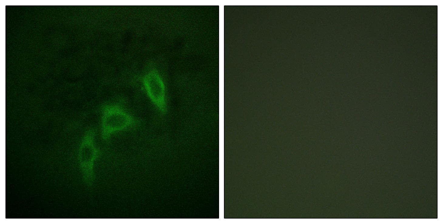 Polyclonal Rabbit anti-Human Tuberin / TSC2 Antibody (p939, IHC, IF, WB)