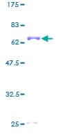 Human PEX16 Protein (Recombinant GST)