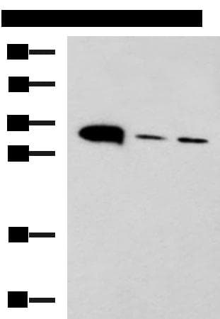 PSCA Antibody